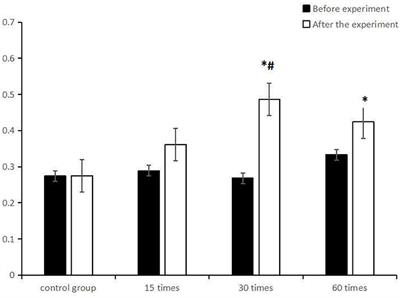 Effect of physical activity combined with extra ciliary-muscle training on visual acuity of children aged 10–11